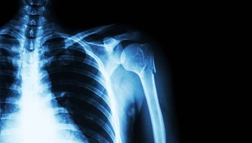 Medical Machining