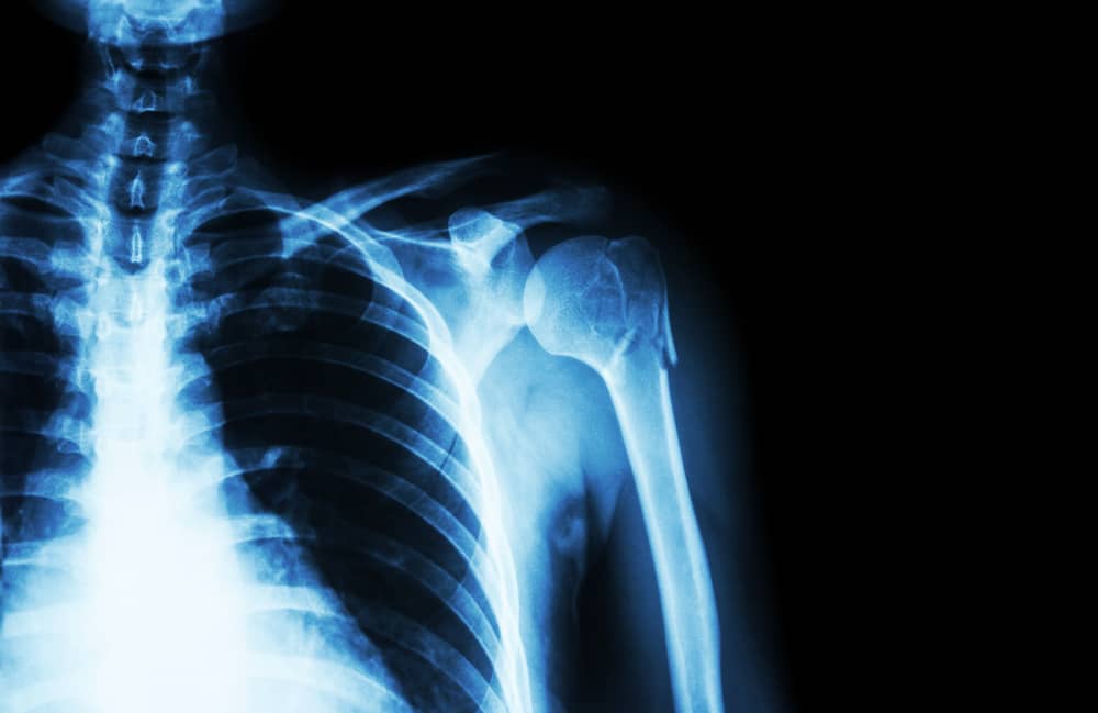 Medical Industry Machined Products